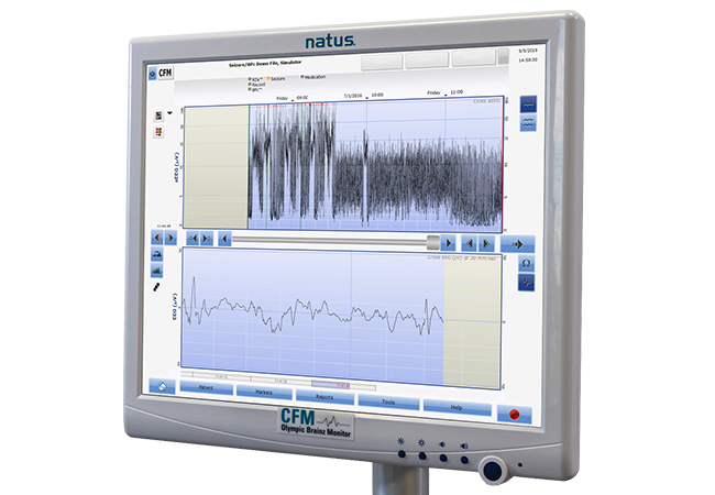 Neuromonitoring And Therapeutic Hypothermia For Neonatal Encephalopathy – 22 Septembre 2021